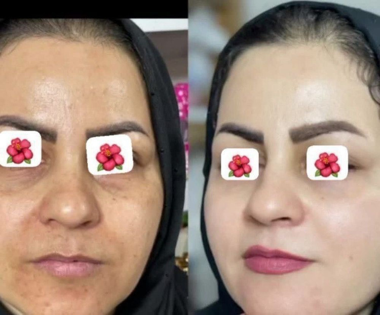 کرم بیومتیک ویتامین سی روشن کننده گاتیو