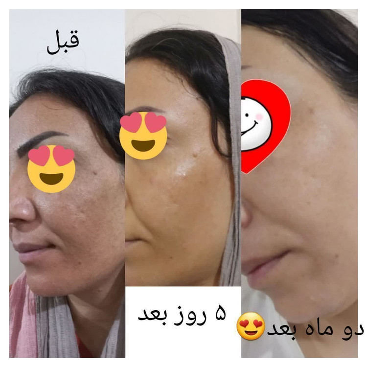 کرم بیومتیک ویتامین سی روشن کننده گاتیو